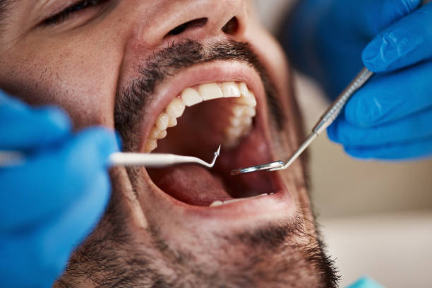 Best Broken Tooth Emergency  in Agua Dulce, TX